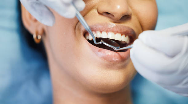 Best Emergency Wisdom Teeth Removal in Des Plaines, IL